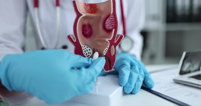 Proctologist doctor inserting rectal suppository into artificial model of human rectum closeup 4k movie slow motion