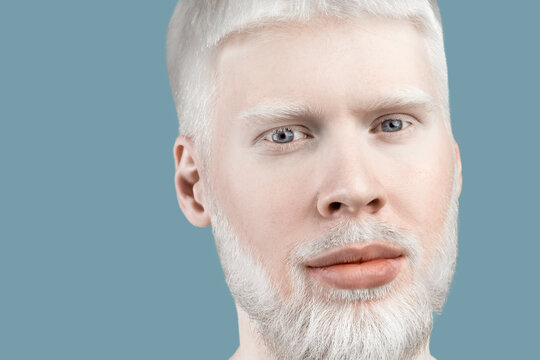 Albinism concept. Portrait of young bearded albino man with white hair, pale skin and blue eyes, turquoise background
