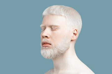 Abnormal deviations concept. Young albino man with closed eyes, pale skin and white hair, turquoise background