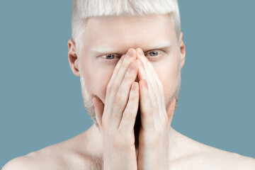 No way. Albino guy covering mouth with both hands and looking at camera, standing speachless over blue background