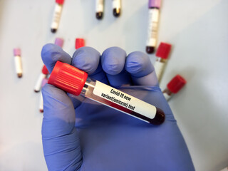 Blood sample tube for Covid 19 omicron variant test. SARS Cov-2 omicron test, corona virus disease.