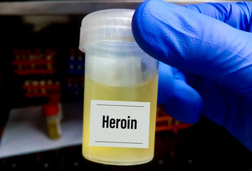 Urine sample for Heroine drug test. Drug test is technical analysis of specimen to determine...