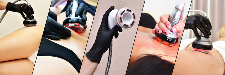 Rf skin tightening. Vacuum massage. Hardware cosmetology. Body care. Non surgical body sculpting....