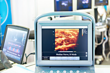 Monitor portable medical ultrasound machine