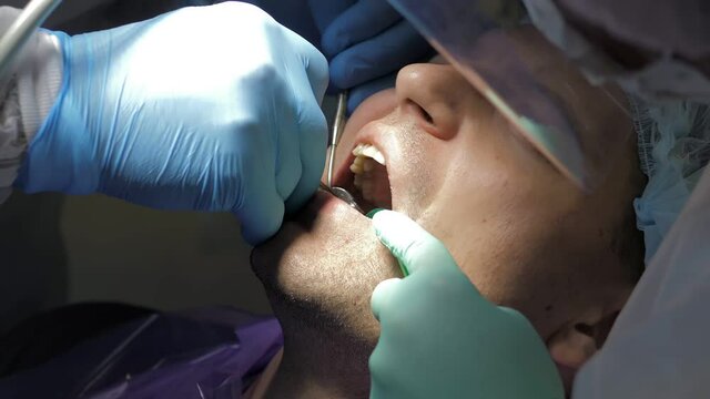The dentist and his assistant treat the patient. Dental treatment in modern dentistry. A close-up shot of a patient in a dental chair undergoing a tooth extraction procedure. Medicine and healthcare.