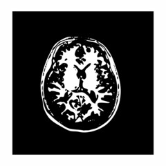 mri of the brain of an adult male on a black background.