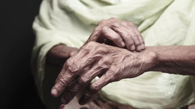 senior women suffering from itching skin, close up.