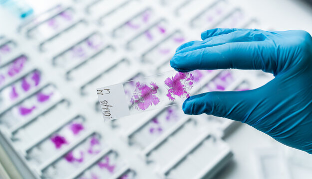 Hand in blue glove holding glass histology slides