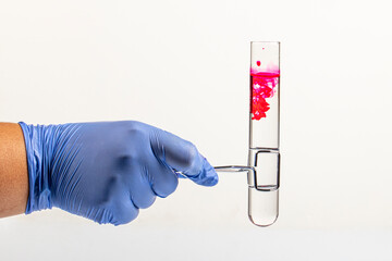 Test tube with red reagent and pipette close-up. Colored liquid in test tube in hand. Blood or...