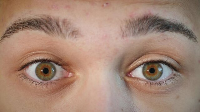 Close up of shocked and surprised male face with hazel eyes raising eyebrows. Young male model with natural central heterochromia and blue brown eye colors looking at camera. Slow-motion, 4K.