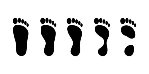 Pictures of different footprints. Various foot shapes and putting weight on the soles of the feet.