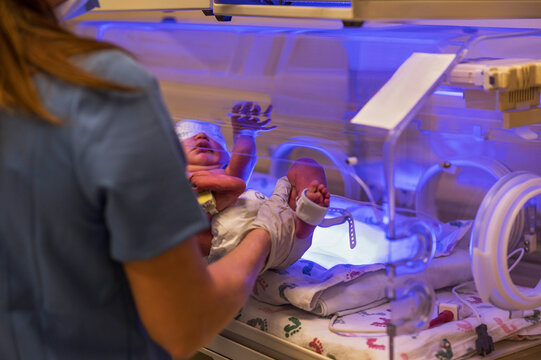 Infant baby girl (0-1 months) treated for jaundice in incubator