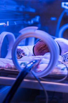 Infant baby girl (0-1 months) treated for jaundice in incubator