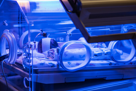 Infant baby girl (0-1 months) treated for jaundice in incubator