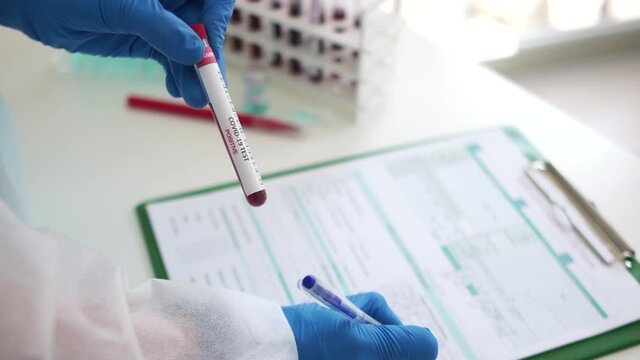 Covid 19 Positive Test. Mass Testing For Coronavirus, Registration Of Laboratory Test Results, PCR Diagnostics, Detection Of Antibodies To The Virus