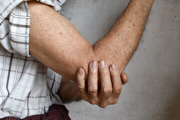 Pain in elbow joint of  Asian elder man. Concept of elbow pain, rheumatoid arthritis and arm...