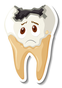 Tooth decay with sad face