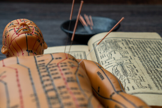 Acupuncture models and medical books are on the table. Acupuncture is a traditional Chinese medical method