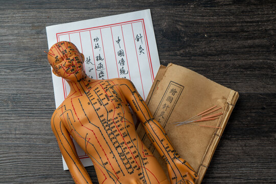 Acupuncture models and medical books are on the table. Acupuncture is a traditional Chinese medical method