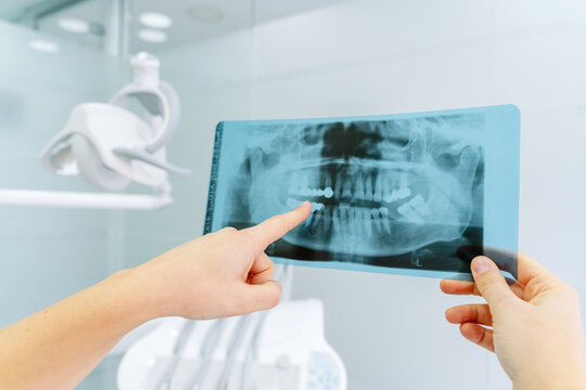 Woman Pointing At Jaw X Ray Image In A Clinic