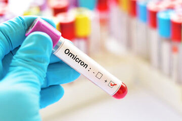 Fototapeta premium Omicron positive, blood sample tube positive with Omicron or B.1.1.529 variant of COVID-19 coronavirus