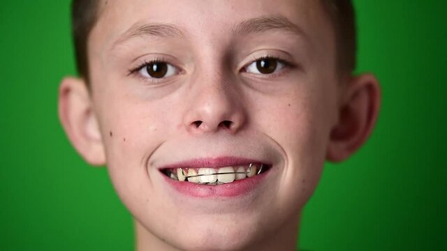 The child puts on a dental plate for alignment of crooked teeth, a portrait of the child on a green background.