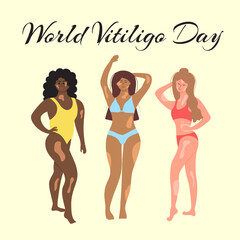 World vitiligo day. Smiling women in swimsuits of different nationalities and physiques with vitiligo. Vector illustration on the topic of rare diseases.