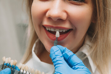 Selection of the correct tooth color for professional cosmetic whitening at the dentist. the doctor...