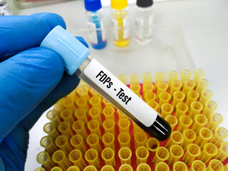Blood sample for Fibrin degradation products (FDPs) test. To diagnosis coagulation disorder