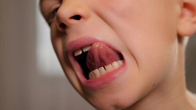 A close-up of a little boy's face with his mouth open, he shows his changing teeth.