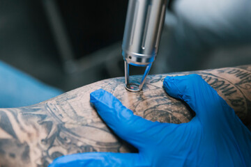 Tattoo master removing tattoo on arm of client