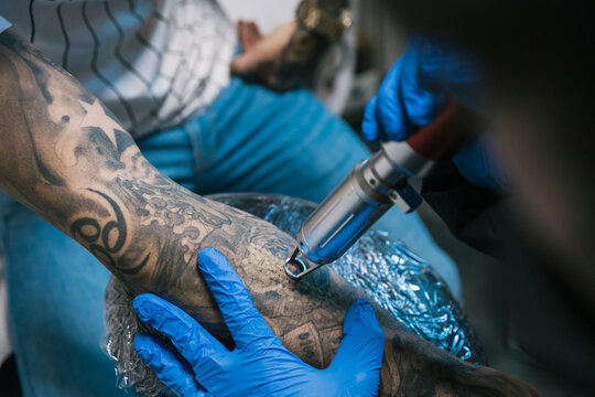 Tattoo master removing tattoo on arm of client