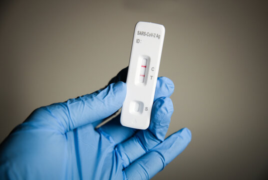 Los Angeles, CA - December 27 2021: At home self administered antigen COVID-19 test kit, Available over-the-counter, the rapid test show patient has tested positive for the Coronavirus.
