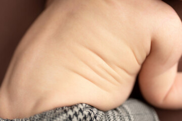 folds on the body of a newborn baby