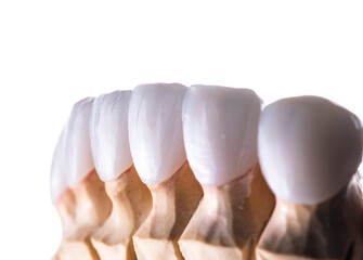 Naklejka premium press ceramic crowns and veneers natural color