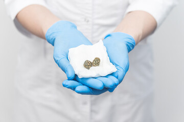 gallbladder stones after surgery in the hands of a doctor