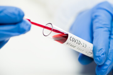 Closeup laboratory test tube containing COVID-19 infected patient's blood