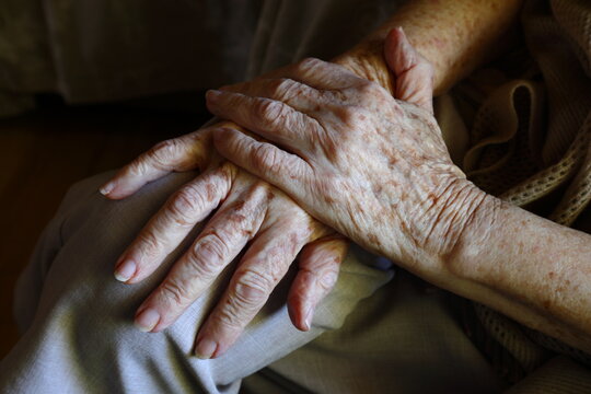 The hands of an elderly woman showing wrinkles and age spots on the skin