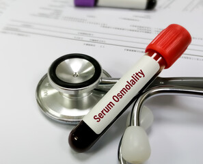 Blood sample isolated with stethoscope for Blood Osmolality test. Serum Osmolality.