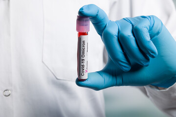 Close up of hands of a lab scientist in medical gloves holding a test tube after virus analysis...