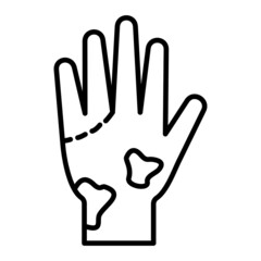 Obraz premium Loss Of Color In Fingers Vector Outline Icon Isolated On White Background