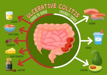 Ulcerative colitis, gut disease dieting. Diet advice for treatment of bowel inflammation. Medical vector illustration