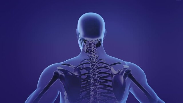 Animation of a painful neck