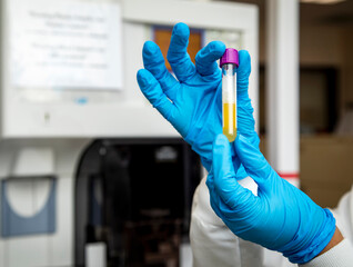Horizontal Image of blue latex gloves holding a test tube of plasma