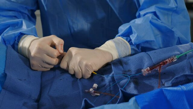 Cardio-vascular examination. Doctor using contrast liquid for uterine fibroid embolization. Vascular surgery. Radiologist performs endovascular operation with angiography machine. 4 k video