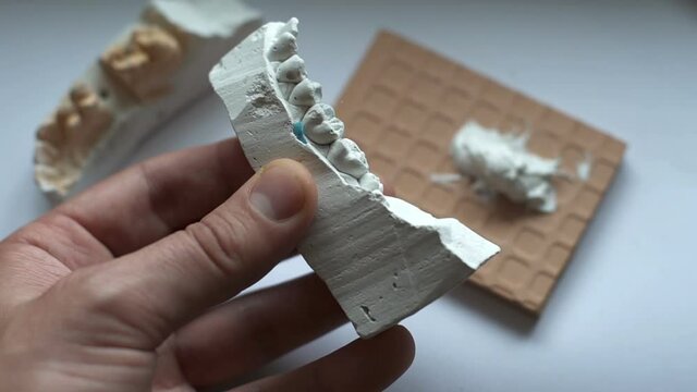 Dental technician work, denture milling, ceramic tooth crown using a plaster model, dental clinic teeth manufacturing.