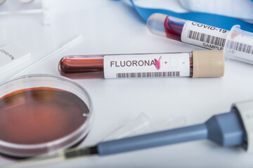Blood samples of new variant OMICRON plus flu FLUORONE, covid19, coronavirus. Selective approach to the sample tube.
