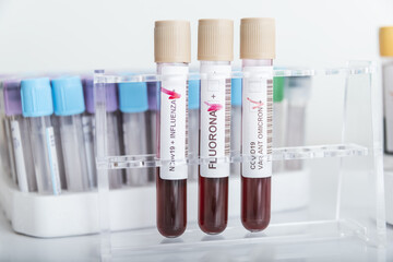 Blood samples of new variant OMICRON plus flu FLUORONE, covid19, coronavirus. Selective approach to the sample tube.