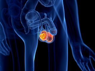 3d rendered illustration of testis cancer © Sebastian Kaulitzki