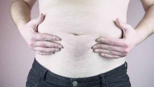 A man shows a big belly. Obesity. Overeating problem. Close-up.